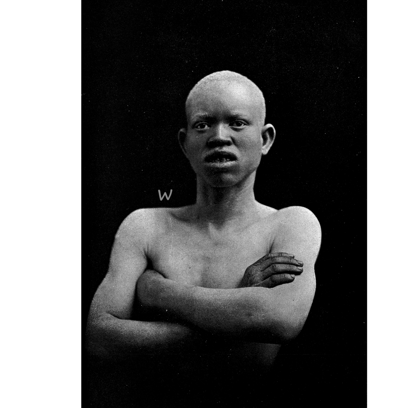 Morfético - A Lenda