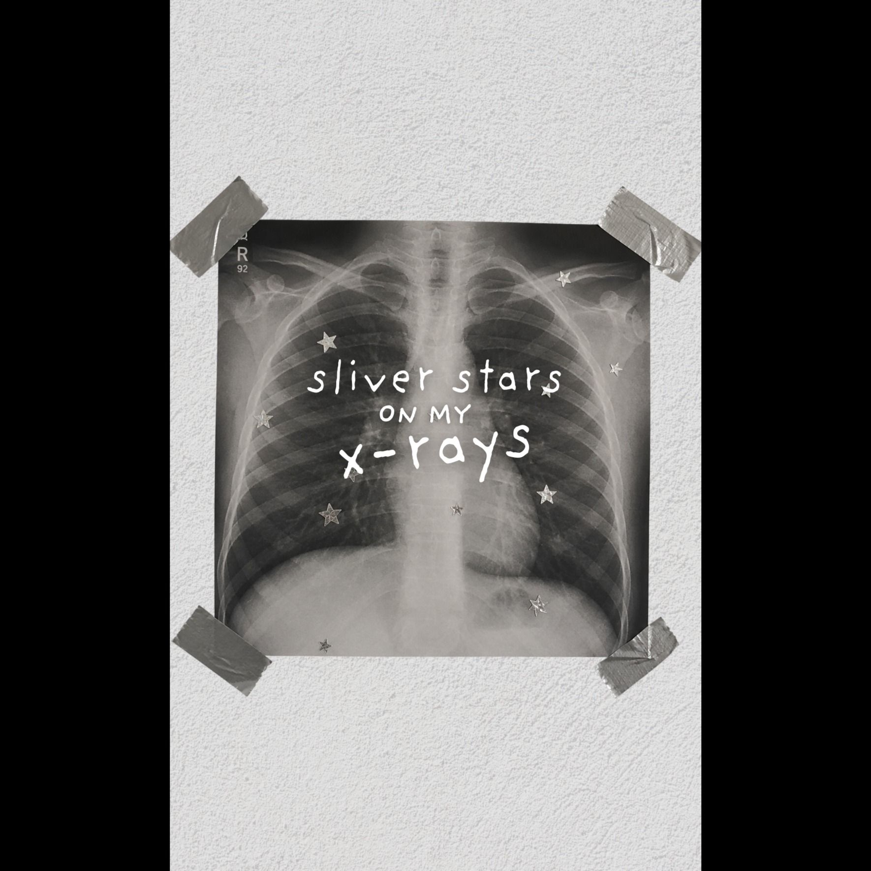 silver stars on my x-rays - REMIX