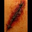 The Scar