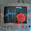 心電図(EKG)